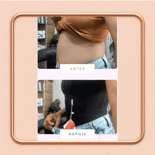 Registro 3 do efeito da cinta Paris Gold no corpo